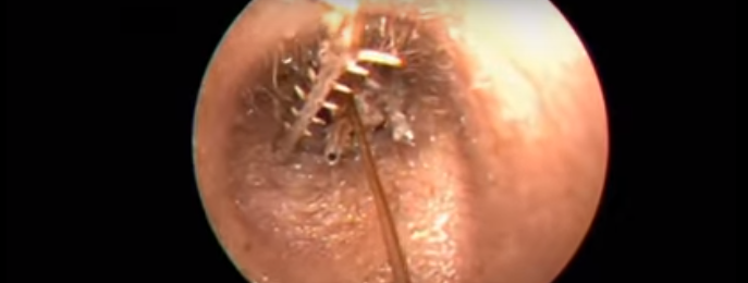 benda seram telinga © 2016 brilio.net benda seram telinga © 2016 brilio.net