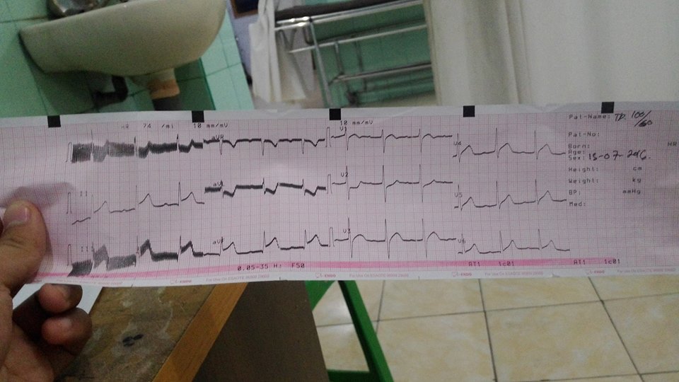 kurangi rokok © 2016 brilio.net kurangi rokok © 2016 brilio.net