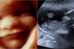 7 Aktivitas bayi di dalam rahim, dari cegukan sampai buang air kecil!