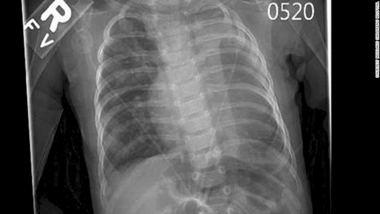 dokter ini selamatkan nyawa seorang bayi © 2016 brilio.net