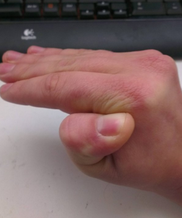 orang lentur ini bikin bengong sekaligus merinding © 2016 brilio.net