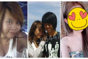 Demi pacarnya, gadis ini rela operasi wajah dan hasilnya bikin melongo