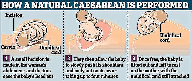 Natural Caesarean, melahirkan dengan cara merangkak ini sedang tren