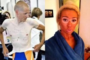 Maunya berkulit eksotis, 15 orang ini malah gagal abis!