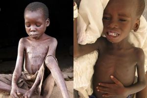 12 Foto anak kelaparan di Afrika ini dijamin bikin air matamu menetes!