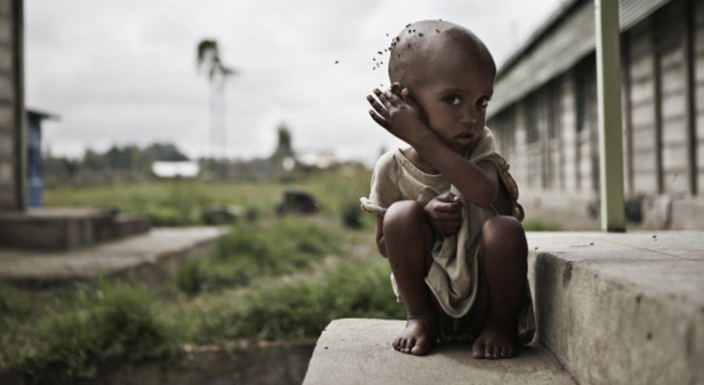 anak kelaparan afrika © 2016 brilio.net
