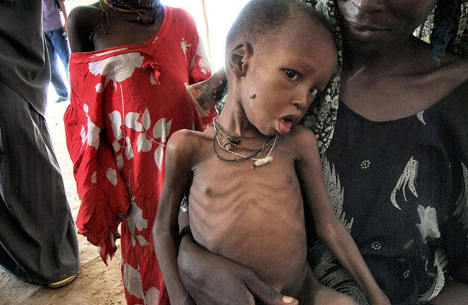 anak kelaparan afrika © 2016 brilio.net