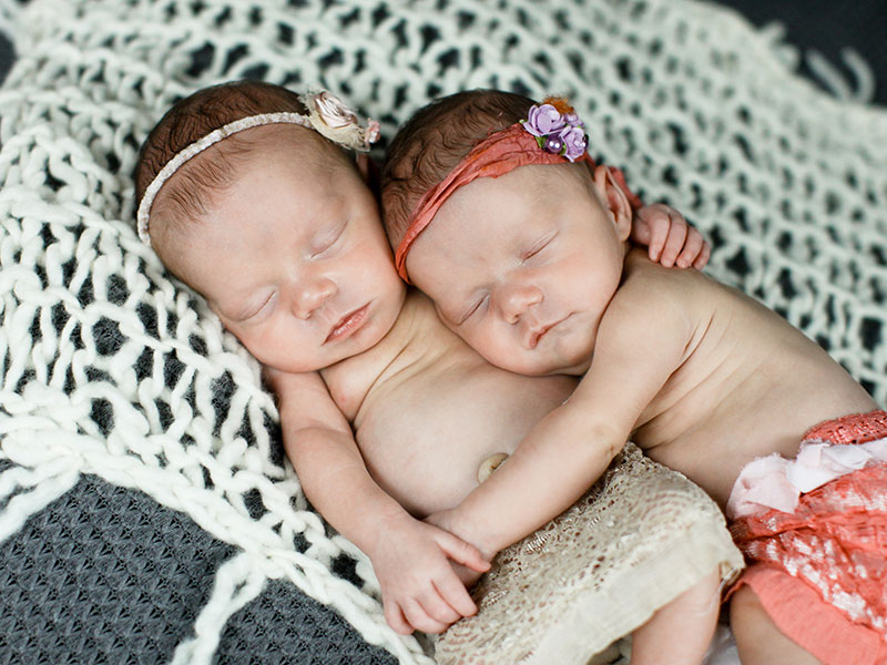 Selamat dari kehamilan terlangka, bayi kembar ini tumbuh menggemaskan