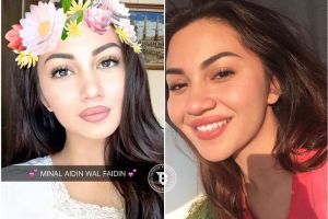 15 Gaya selfie cewek antimainstream, kamu berani tiru?