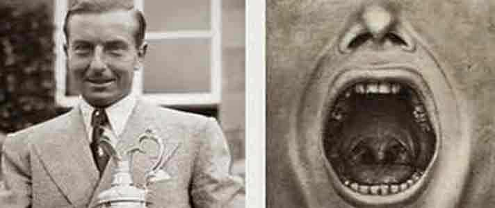 pengobatan sakit jiwa © 2016 brilio.net pengobatan sakit jiwa © 2016 brilio.net