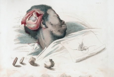 pengobatan sakit jiwa © 2016 brilio.net pengobatan sakit jiwa © 2016 brilio.net