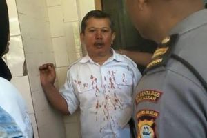 Guru korban pemukulan siswa & orangtua alami patah hidung