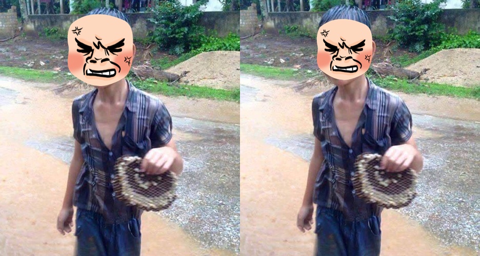 Foto senyuman bocah usai disengat lebah ini mendadak viral, kenapa ya?
