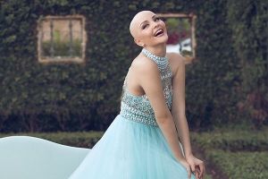 Tanpa rambut, 7 wanita penderita kanker ini tetap PD di depan kamera