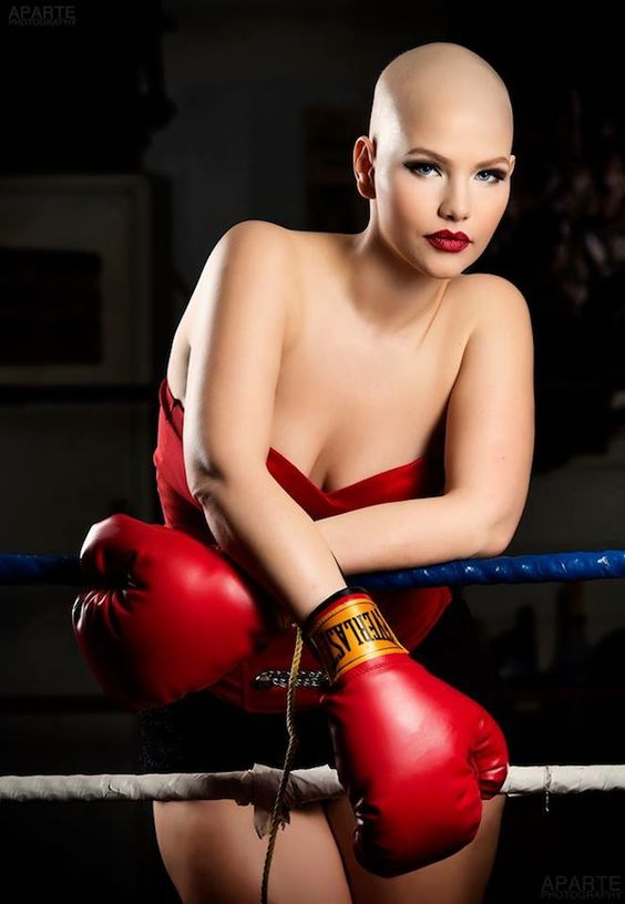 7 wanita penderita © 2016 brilio.net