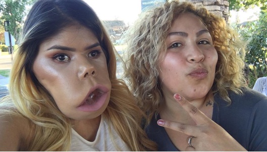 cystic higroma © 2016 brilio.net cystic higroma © 2016 brilio.net