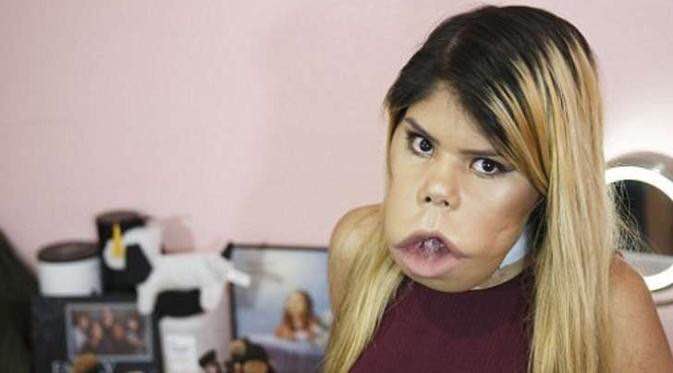 Idap tumor di wajah tak halangi gadis ini menjadi video blogger sukses
