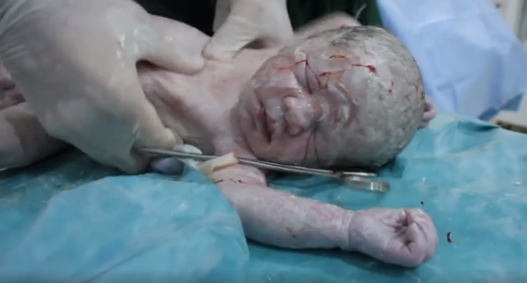 Bayi selamat dari serangan udara di Suriah ini bikin terenyuh