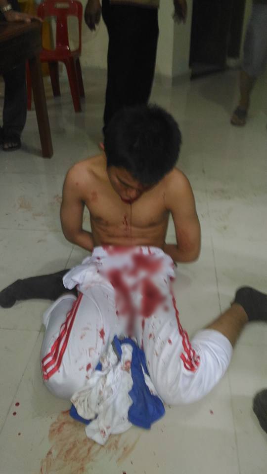 bom medan © 2016 brilio.net bom medan © 2016 brilio.net