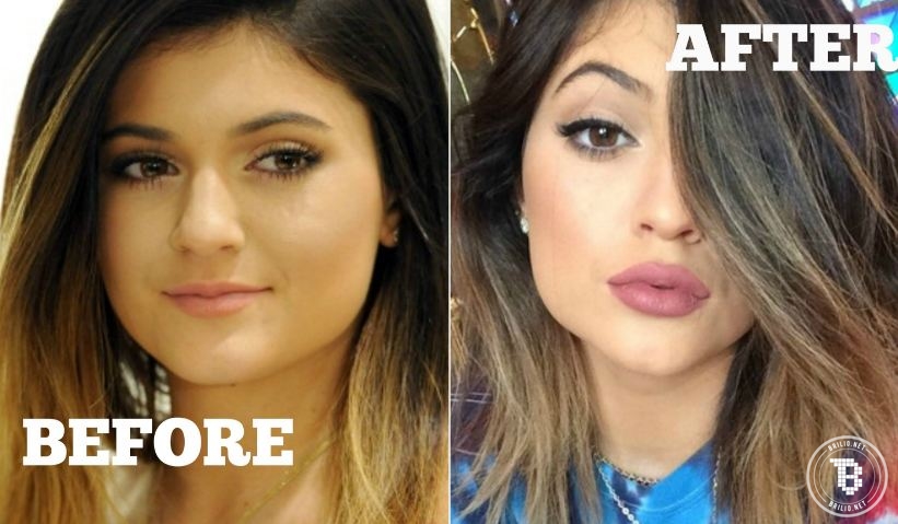 7 Langkah makeup bibir ala Kylie Jenner, nggak perlu oplas