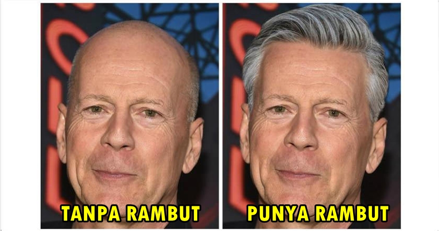 Begini jadinya jika 8 artis Hollywood gundul diedit jadi punya rambut