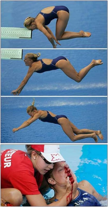 voltaren celaka Istimewa voltaren celaka Istimewa