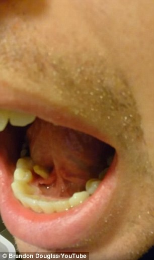 Dikira gigi tumbuh, benda yang keluar dari mulut pria ini bikin kaget