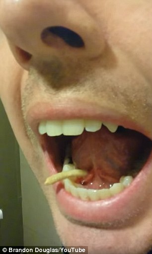 Dikira gigi tumbuh, benda yang keluar dari mulut pria ini bikin kaget