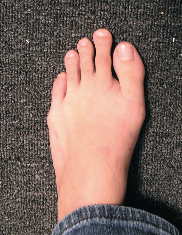 Bentuk jari dan telapak kaki bisa ungkap kepribadian, kamu yang mana?