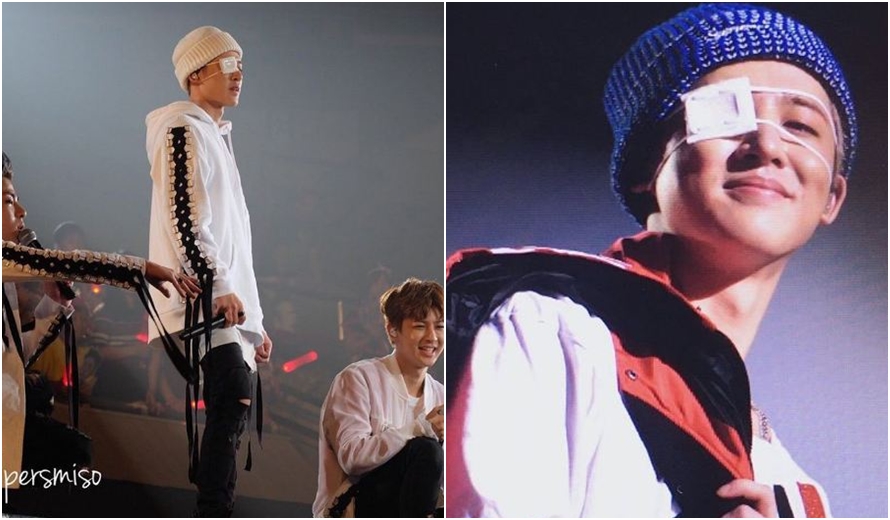 kpop tampil cedera © 2016 brilio.net