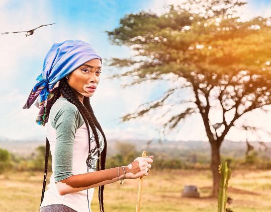 Winnie Harlow © 2016 Instagram