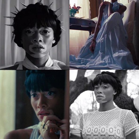 Winnie Harlow © 2016 Instagram