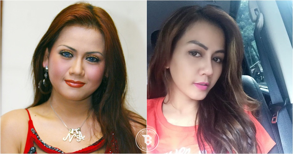 4 Potret sebelum & sesudah artis operasi plastik, makin cantik nggak?