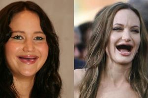 12 Foto editan artis Hollywood jadi ompong, masih tetep cantik nggak?