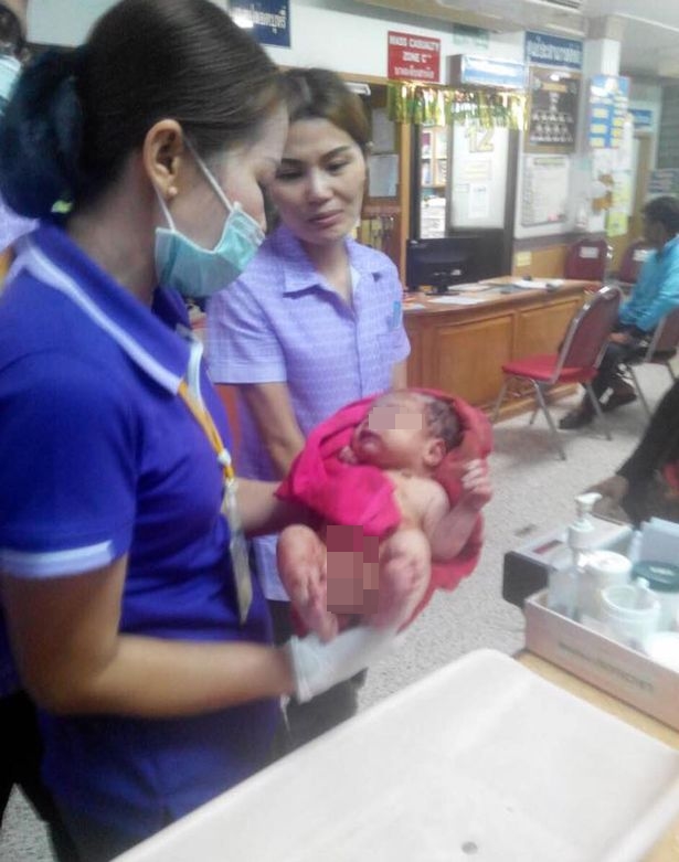 bayi ajaib hidup © 2016 brilio.net