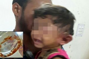 80 Ekor ulat bersarang di telinga bocah ini, sang dokter sampai heran