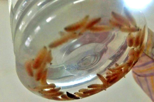 puluhan ekor ulat bersarang di telinga bocah ini © 2016 Siakap Keli