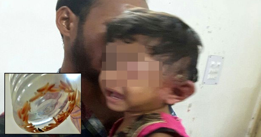 80 Ekor ulat bersarang di telinga bocah ini, sang dokter sampai heran