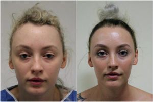 Kebiasaan nyepol rambut bisa bikin botak lho, hati-hati ya ladies