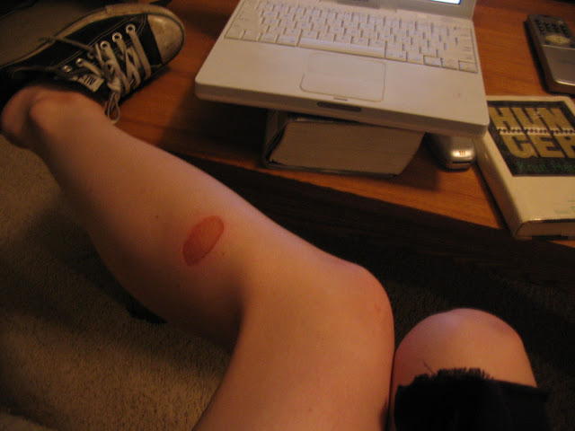 cedera masa kecil  © 2016 brilio.net