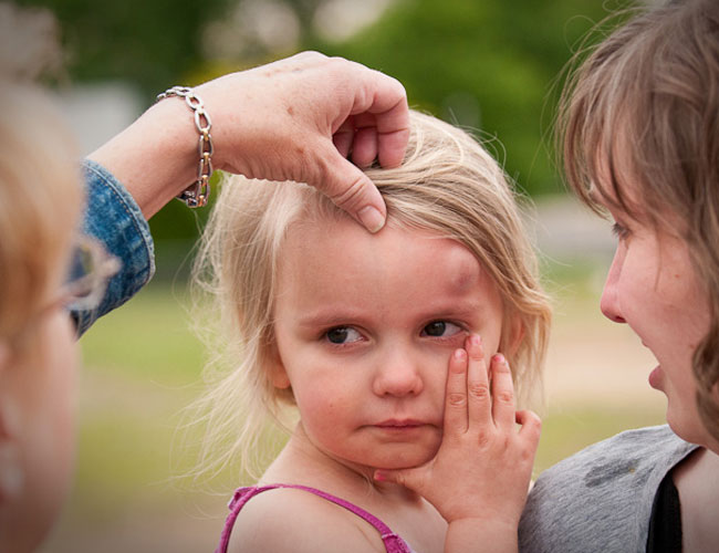 cedera masa kecil  © 2016 brilio.net