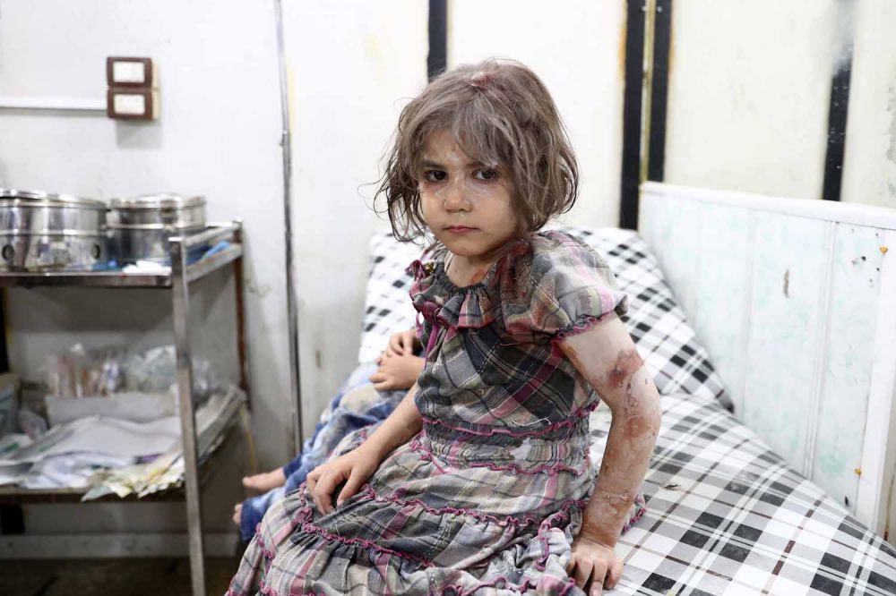 15 Foto mengiris hati anak-anak korban perang Suriah sepanjang 2016
