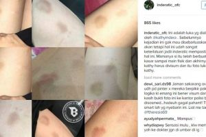 Beredar foto Kathy Indera lebam, benarkah dianiaya ibu Natasha Wilona?