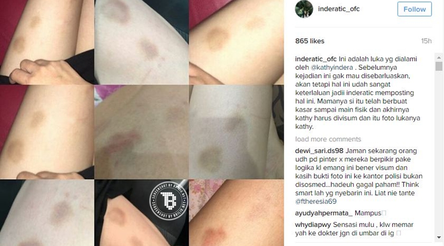 Beredar foto Kathy Indera lebam, benarkah dianiaya ibu Natasha Wilona?