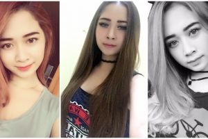 Ini foto-foto Intan Novita, gadis cantik yang disiram air keras, duh