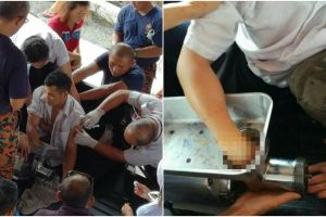 Ngeri, tangan pria ini terjepit di dalam mesin penggiling daging
