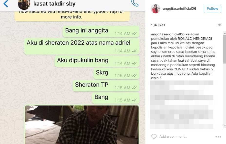 Anggita Sari lebam © 2016 brilio.net