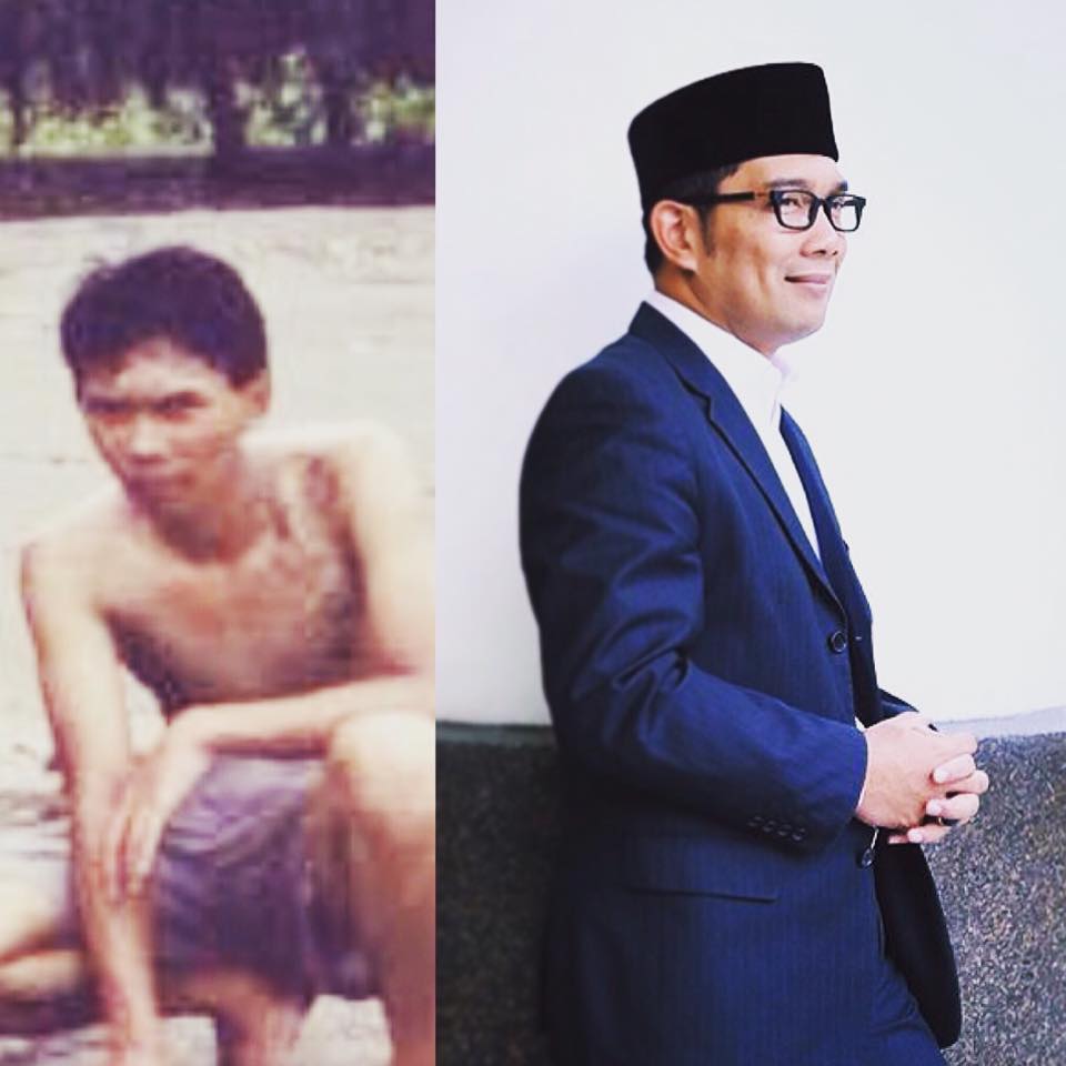 8 Foto masa lalu Ridwan Kamil ini culun abis, bikin pangling deh