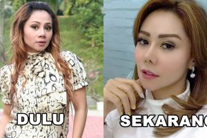 Diisukan oplas, ini 10 foto Femmy Permatasari yang kini makin cantik