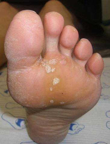 Bahaya Menicure ranker.com Bahaya Menicure ranker.com